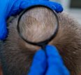 How to Get Rid of Demodex Mites on Scalp - Dr Gary Marder